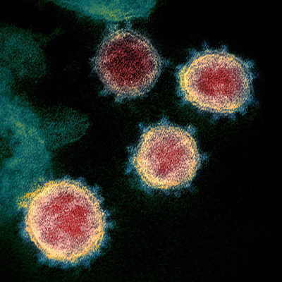 Das Coronavirus (SARS-CoV-2) unter dem Elektronenmikroskop. Bild: NIAID Rocky Mountain Laboratories